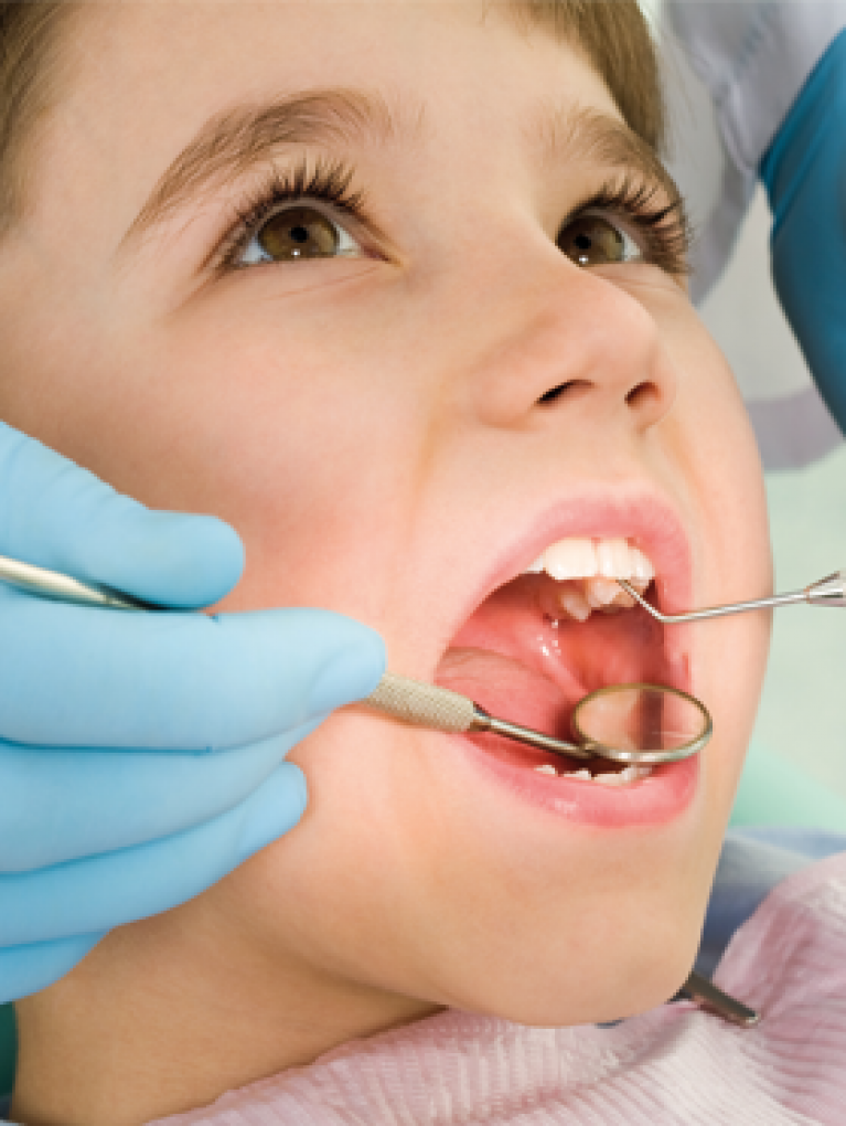 denti storti